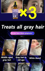 White Hair Killer – Gray Hair Remover & Natural Color Restorer (7 Days)