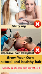 WPRBREGT Blue Bottle Hair Growth Essential Oil