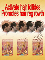 WPRBREGT Blue Bottle Hair Growth Essential Oil