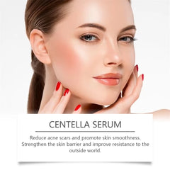Centella Serum – Hydrating, Firming & Brightening Face Essence (50ml)