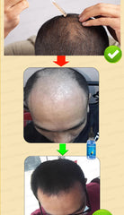 WPRBREGT Blue Bottle Hair Growth Essential Oil