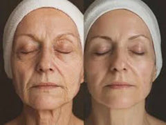 Advanced Snail 96 Mucin Essence – Hydrating, Firming & Brightening