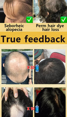 WPRBREGT Blue Bottle Hair Growth Essential Oil