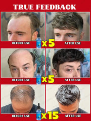 WPRBREGT Blue Bottle Hair Growth Essential Oil