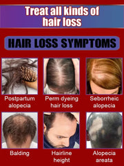 WPRBREGT Blue Bottle Hair Growth Essential Oil