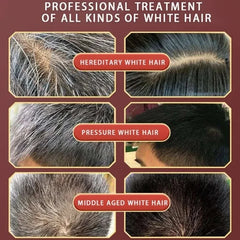 Herbal Hair Dye Shampoo – Natural Gray & White Hair Coverage with Plant Extracts