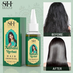 Ayurvedic Adivasi Hair Growth Oil – Organic Regrowth & Anti-Hair Loss Serum