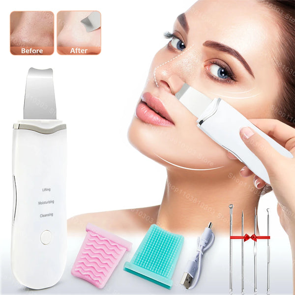 Ultrasonic Skin Scrubber – Electric Face Spatula for Deep Cleansing & Blackhead Removal