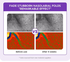 Retinol + Pro-Xylane Ampoules – Anti-Aging & Skin Repair Serum (15pcs)