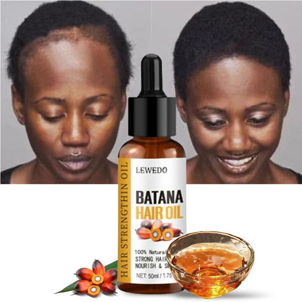 Lewedo Naturals Batana Oil – Pure Hair Growth & Anti-Hair Loss Care