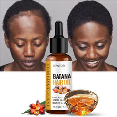 Lewedo Naturals Batana Oil – Pure Hair Growth & Anti-Hair Loss Care