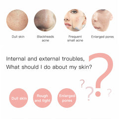 Ultrasonic Skin Scrubber – Electric Face Spatula for Deep Cleansing & Blackhead Removal