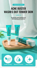 Salicylic Acid Acne Cream – Anti-Acne, Pimple & Redness Repair