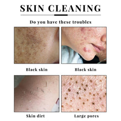 Handmade Kojic Acid Soap