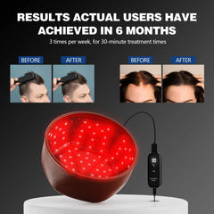 Hair Growth Cap for Hair Loss