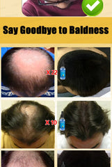 WPRBREGT Blue Bottle Hair Growth Essential Oil