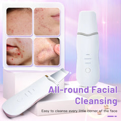 Ultrasonic Skin Scrubber – Electric Face Spatula for Deep Cleansing & Blackhead Removal
